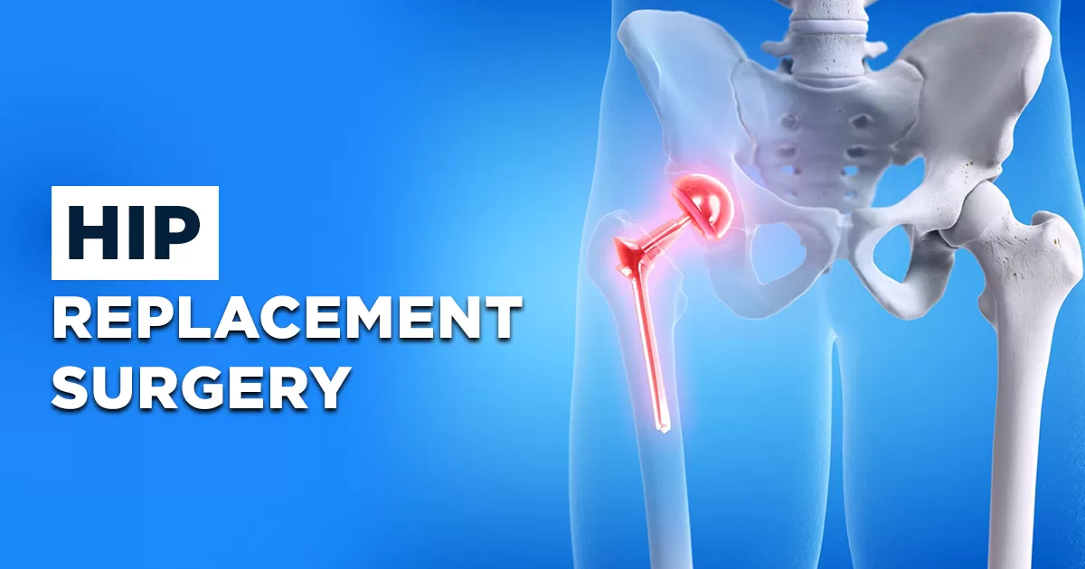 Hip Replacement Surgery in Greater Noida West